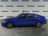 2024 Hyundai Elantra Preferred image 2